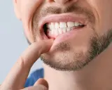 Mężczyzna bada palcem diastemę, widoczną przerwę między przednimi zębami.
