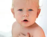 Visage d'un bébé aux yeux bleus, présentant des rougeurs autour de la bouche, possiblement un eczéma bouche bébé.