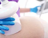 Endermologia: Jak często? Ekspert radzi, by cellulit nie wrócił