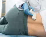 Lekarz wykonuje badanie USG, które może pomóc w diagnostyce problemów z nerkami, np. przed zabiegiem nefrostomia co to jest.