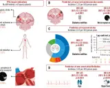 PFO closure indications: 80% kryptogenny udar, 17% TIA. Obraz przedstawia objawy neurologiczne i czynniki ryzyka udaru.