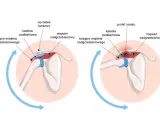 Anatomia barku: ścięgno mięśnia nadgrzebieniowego w zdrowej pozycji i podczas ucisku, pokazujące jego relację z kaletką podbarkową i wyrostkiem barkowym.