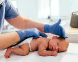 Medico controlla la schiena di un neonato, notando una piccola fossetta sacrale.
