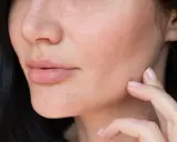 Dita che accarezzano il viso, mostrando come idratare la pelle del viso molto secca per un aspetto radioso e morbido.
