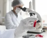 Ręka w rękawiczce trzyma probówkę z krwią do badania BNP. W tle naukowiec pracuje przy mikroskopie.