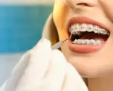 Uśmiech z aparatem na dolne zęby. Dentysta sprawdza zęby pacjentki.