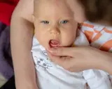 Widok na buzię niemowlaka, któremu rodzic delikatnie podnosi wargę, ukazując, jak wygląda przebijający się zabek.