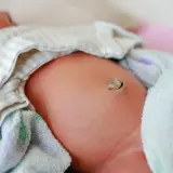 Żółty pępek po odpadnięciu kikuta, delikatnie owinięty w miękkie tkaniny.