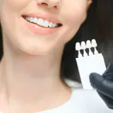 Uśmiechnięta kobieta z białymi zębami, dentysta porównuje odcień zębów z wzornikiem przed wybielaniem.