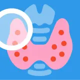 Ilustracja przedstawia tarczycę pod lupą, sugerującą diagnostykę subklinicznej niedoczynności tarczycy.
