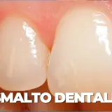 Primo piano di denti sani, con smalto lucido e gengive rosa. Un esempio di smalto dentale forte, pronto per la remineralizzazione.
