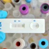 Rękawiczka trzyma test PSA, który wskazuje wynik. W tle widać probówki, co sugeruje badanie psa i przygotowanie do analizy.