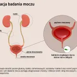Schemat układu moczowego z zaznaczonym pęcherzem moczowym. Obok widok bakterii.