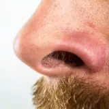 Primer plano de una nariz con poros visibles y algunas espinillas negras. Se aprecia vello facial en la parte inferior.