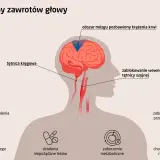 Ilustracja przedstawia przyczyny zawrotów głowy i wymiotów: blokady tętnic, choroby mózgu, infekcje ucha, zaburzenia metaboliczne i sercowo-naczyniowe.
