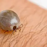 W którą stronę wykręcić kleszcza? Kluczowe wskazówki na pewno pomogą