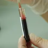 Czy leki na HIV są refundowane? Sprawdź, co musisz wiedzieć o dostępności