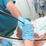 Lekarz w niebieskich rękawiczkach wykonuje bronchoskopię, wprowadzając endoskop do dróg oddechowych pacjenta.