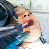 Dentysta wykonuje zabieg leczenia kanałowego. Czas leczenia kanałowego zależy od wielu czynników.