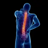 Ból kręgosłupa, który może być objawem osteoartrozy. Co to jest i jak sobie z tym radzić?
