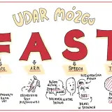 Objawy udaru mózgu: FAST. Asymetria twarzy, osłabienie siły mięśniowej, nieadekwatne słowa, braki w słowach, niewyraźna mowa, nie marnuj czasu. Czasownik to czynność, np. "daj mi".