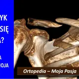 Trójwymiarowy obraz obojczyka, który pokazuje, ile zrasta się kość po urazie. "Ortopedia – Moja Pasja #064".