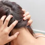 Persona se rasca la cabeza, indicando un problema de higiene del cabello.