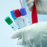 Czy badania hormonalne są na NFZ? Sprawdź, co musisz wiedzieć