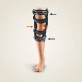 Ein Bein mit einer valgisierenden Orthese, die das Knie stabilisiert. Pfeile zeigen auf die Gelenke der Orthese.
