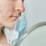 Primo piano di un viso con evidenti segni di acne da mascherina. La persona tiene una mascherina blu e bianca vicino al mento.