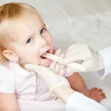 Lekarz bada gardło dziecka, podejrzewając zapalenie krtani. Dziecko ma otwarte usta, a lekarz używa drewnianego patyczka.