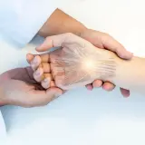 Dłoń z widocznymi nerwami, sugerującymi chorobę stawów dłoni. Lekarz bada pacjenta.
