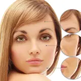 Kvinnas ansikte med närbilder som visar rynkor före och efter behandling med retinoid eller retinol.