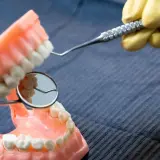 Model szczęki z widoczną próchnicą z boku zęba, badany lusterkiem dentystycznym.
