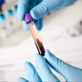 Rękawiczki z niebieskiej lateksowej rękawiczki trzymają probówkę z krwią. Morfologia cena badania.