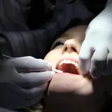 Dentysta w białej rękawiczce wykonuje zabieg zatruwania zęba u pacjentki.