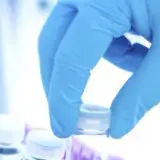 Jak się bada kreatyninę? Kluczowe informacje i przygotowania do testu