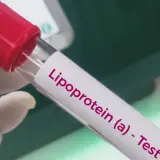 Rękawiczka laboratoryjna trzyma probówkę z napisem "Lipoprotein (a) - Test". To badanie ocenia poziom lipoproteiny (a), ważnego markera ryzyka sercowo-naczyniowego.