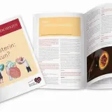 Cholesterin Medikamente: Wirksame Lösungen für hohe Cholesterinwerte