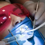 Precyzyjne leczenie kanałowe pod mikroskopem. Dentysta w rękawiczkach używa narzędzi i strzykawki. Pacjent ma założone różowe okulary ochronne.