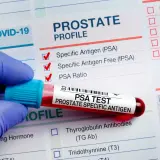 Rękawiczka trzyma probówkę z krwią do badania PSA. Wyniki analizy PSA pomogą ocenić, jak obniżyć psa prostaty.
