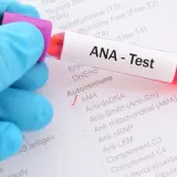 Badanie ANA - Test wykrywa przeciwciała przeciwjądrowe, kluczowe w diagnostyce chorób autoimmunologicznych.