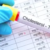 Jak stres podnosi cholesterol i co możesz z tym zrobić dla zdrowia