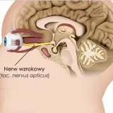 Schematyczny przekrój głowy ukazujący oko i mózg. Strzałka wskazuje nerw wzrokowy, którego uszkodzenie może prowadzić do utraty wzroku.