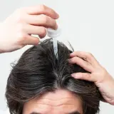 Persona aplica un gotero en su cuero cabelludo, buscando alternativas al minoxidil para el crecimiento capilar.