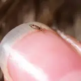 Un pidocchio, un fastidioso ospite per i bambini, si muove su un'unghia.