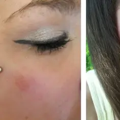 Jak bezpiecznie wykonać microdermal kolczyk - krok po kroku