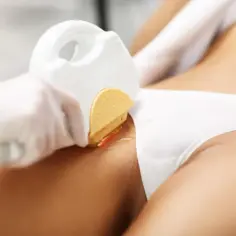 Jak przygotować się do depilacji laserowej bikini, aby uniknąć problemów