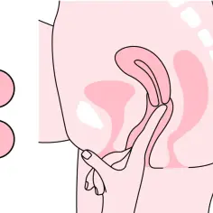Ilustracja pokazuje badanie ginekologiczne, porównujące szyjkę macicy do kropki i gwiazdki, symbolizując zmiany w jej wyglądzie. Pokazuje też badanie palpacyjne, które pomaga ocenić wysokość dna macicy w ciąży.