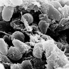 Mikroskopowe zdjęcie bakterii Yersinia pestis, wywołujących dżumę płucną.